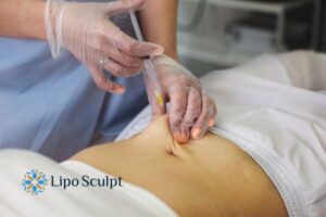 Does Skin Sag After Fat Dissolving Injections? 2 Do you want to get Aqualyx fat dissolving injections Kirkstall but worried about loose skin afterwards?