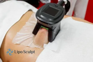 Are The Results From Aqualyx Permanent? 4 Compare Aqualyx Kirkstall to other fat reduction treatments.