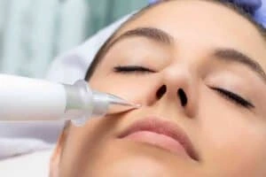 Best Actinic Keratoses Removal 3 Actinic keratoses Kirkstall solutions - book in today!